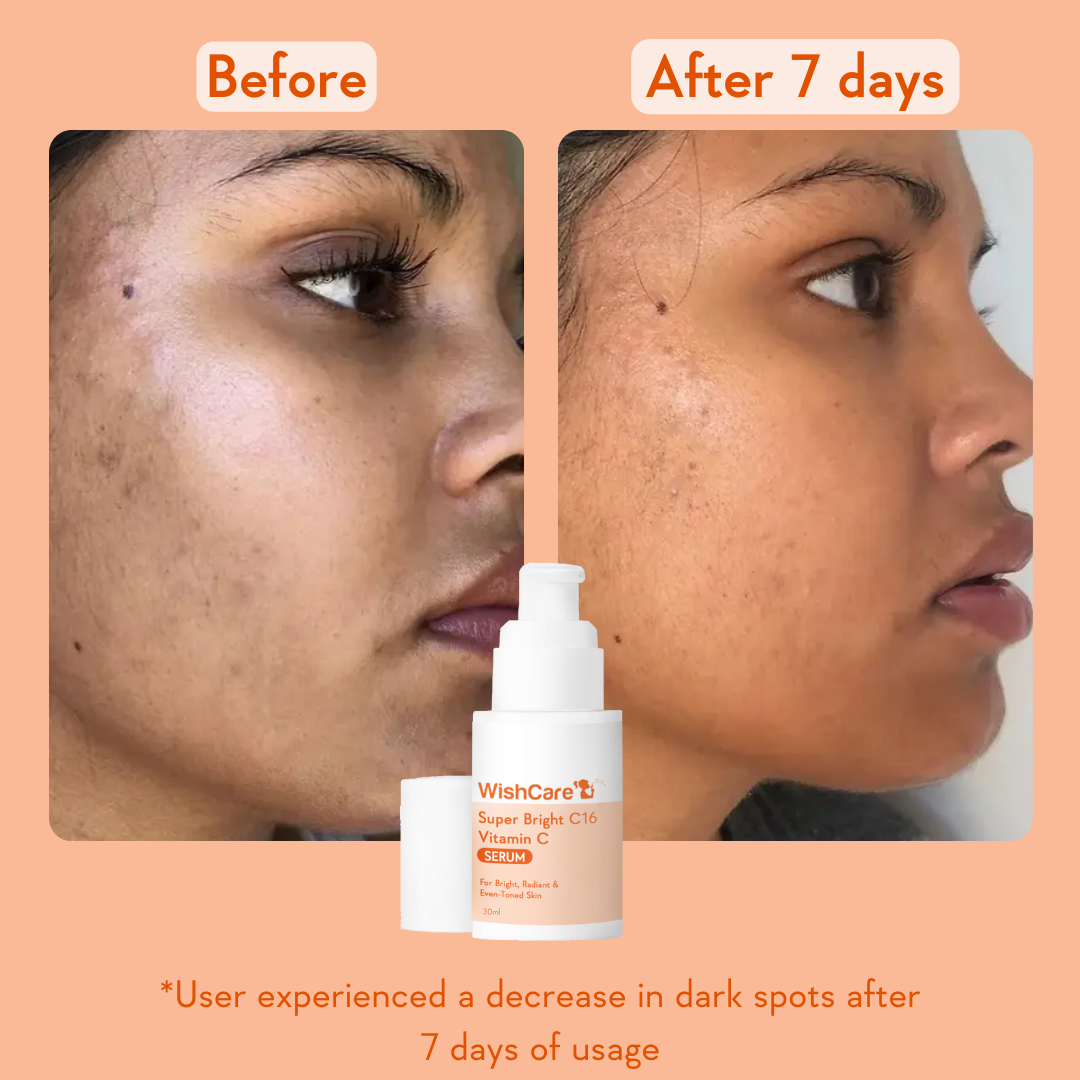 Super Bright Vitamin C16 Serum | 30ml