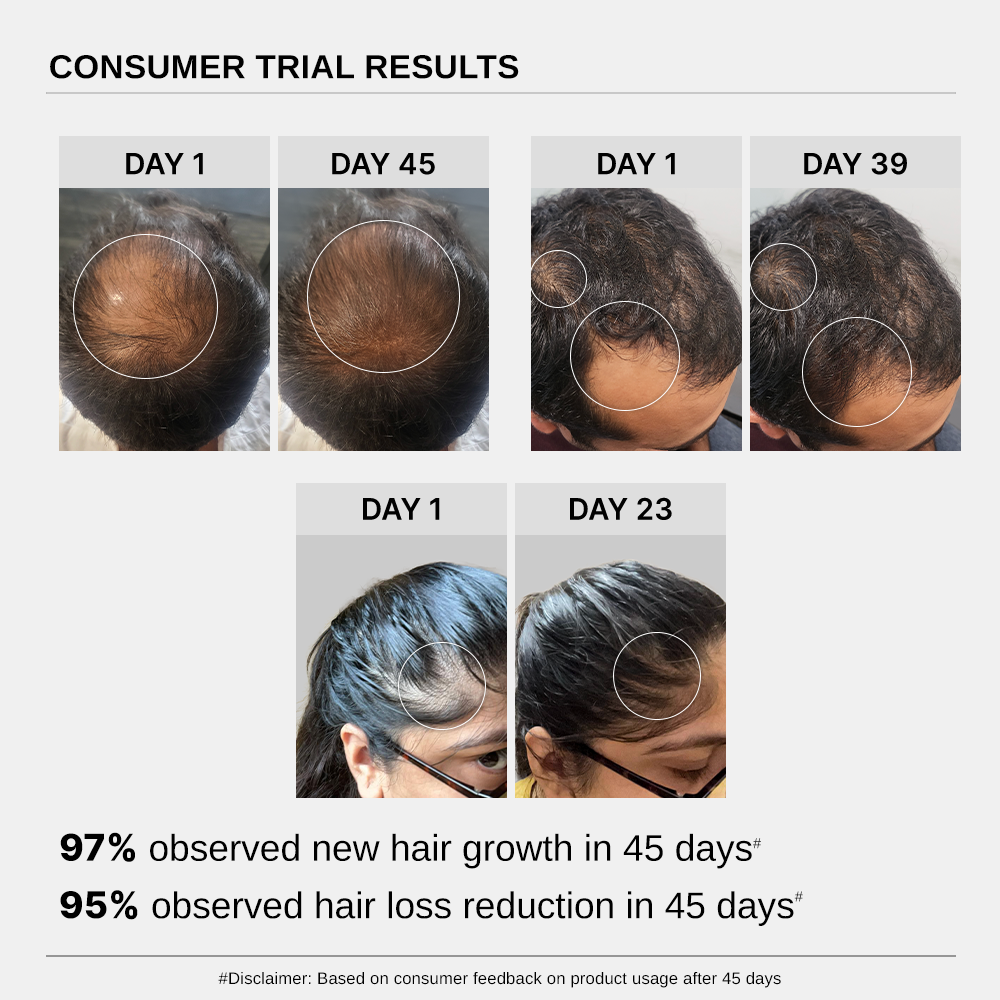 Hair Growth Serum (Pack of 2) & Scalp Massager Hair Growth Combo