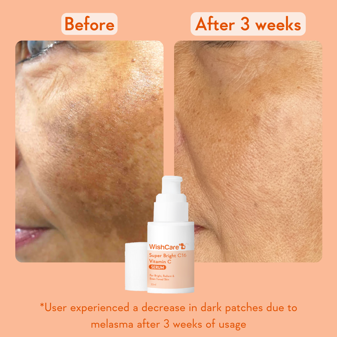 Super Bright Vitamin C16 Serum | 30ml