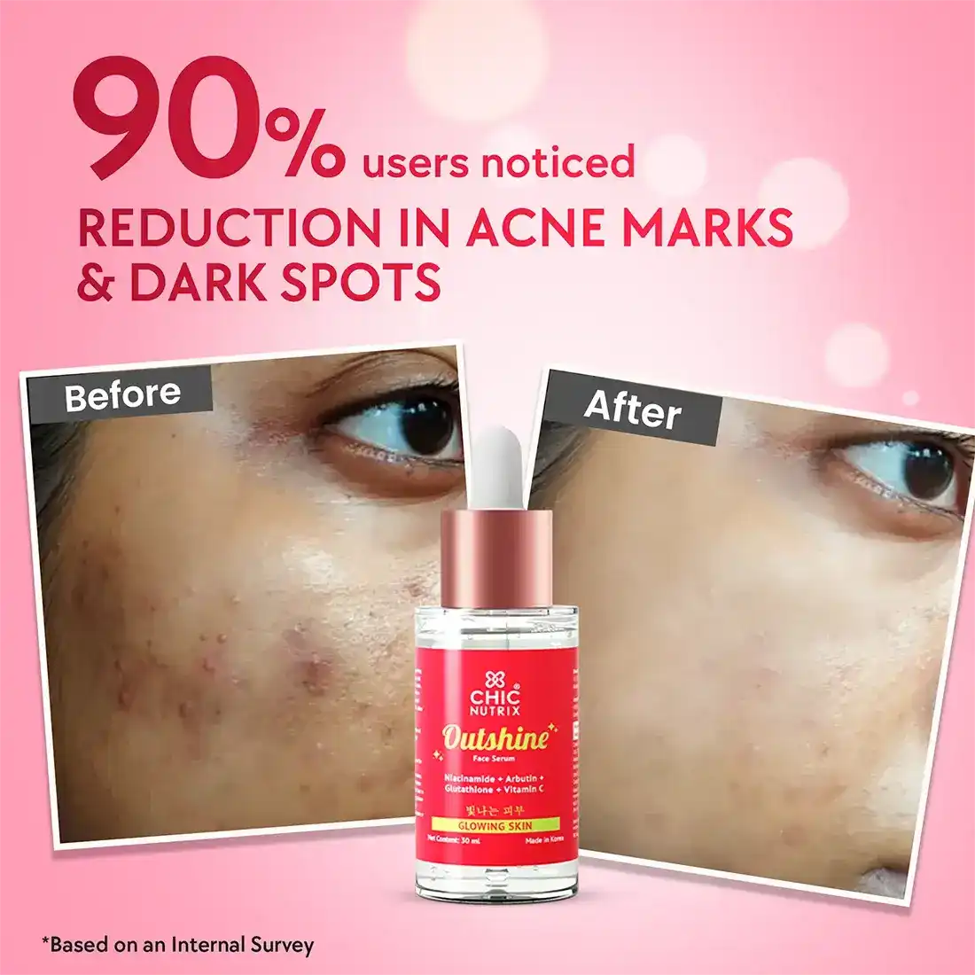 Outshine Korean Face Serum – Fades Dark Spots & Brightens Skin with Glutathione, Niacinamide & Vitamin C