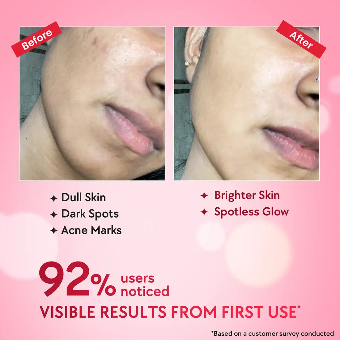 Outshine Korean Face Serum – Fades Dark Spots & Brightens Skin with Glutathione, Niacinamide & Vitamin C