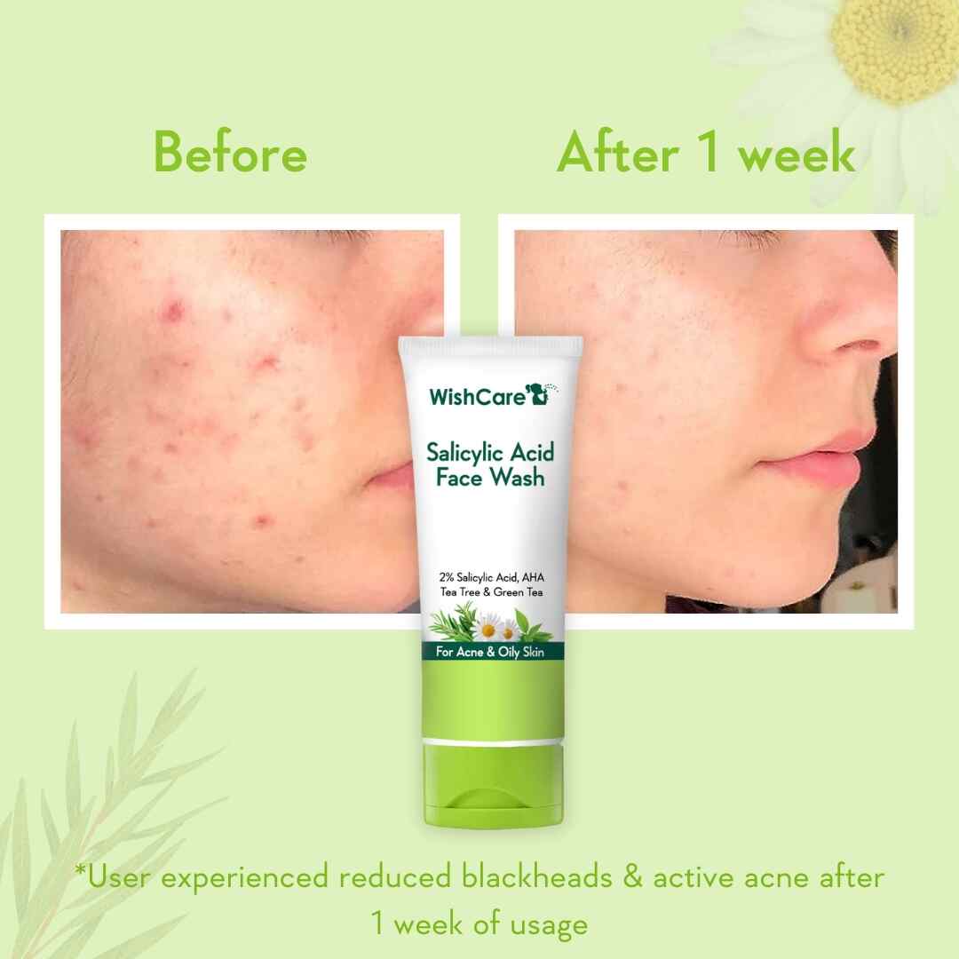2% Salicylic Acid Face Wash | 100ml